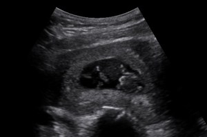 Here is our little peanut...my friends and I took this picture in our ultrasound lab at school! One of my favorite parts about being pregnant in med school is unlimited ultrasounds!!